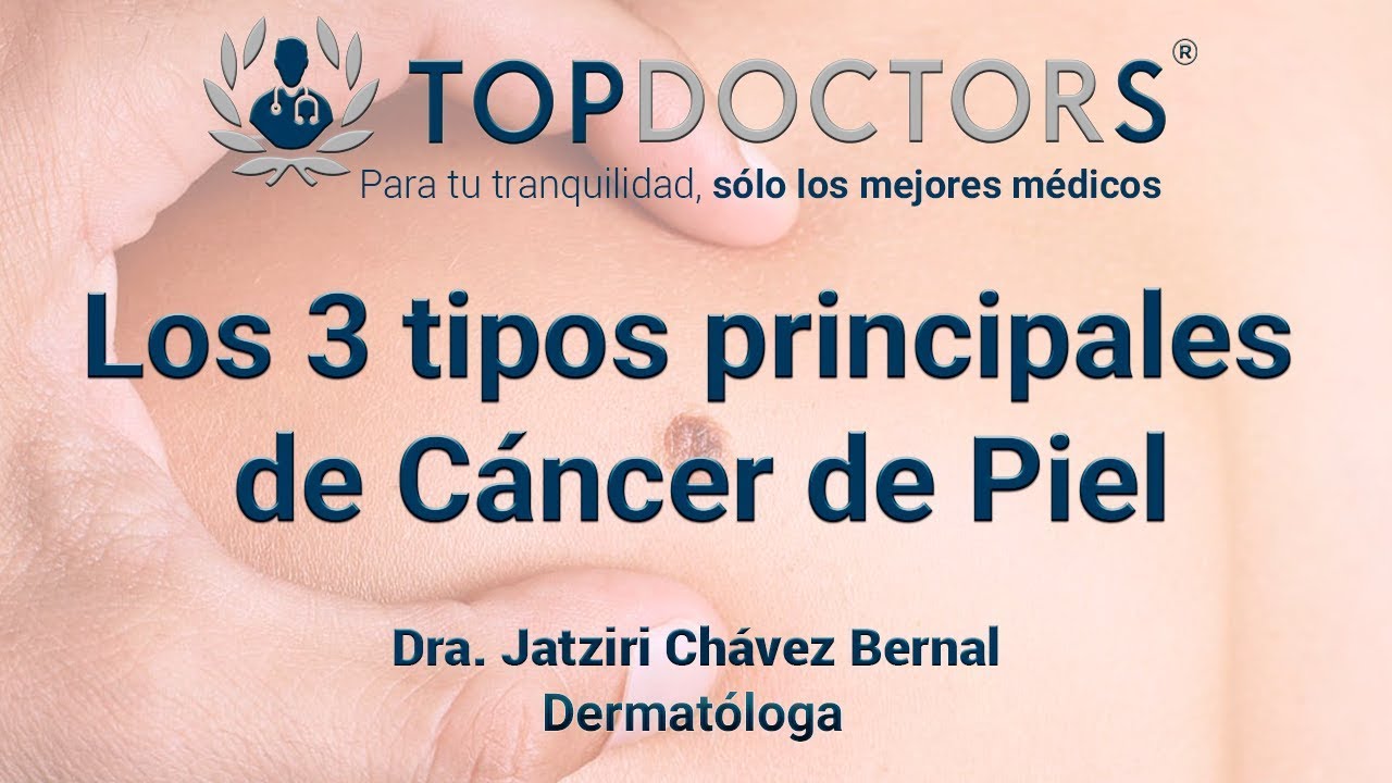Los 3 tipos m&aacute;s importantes de C&aacute;ncer de piel
