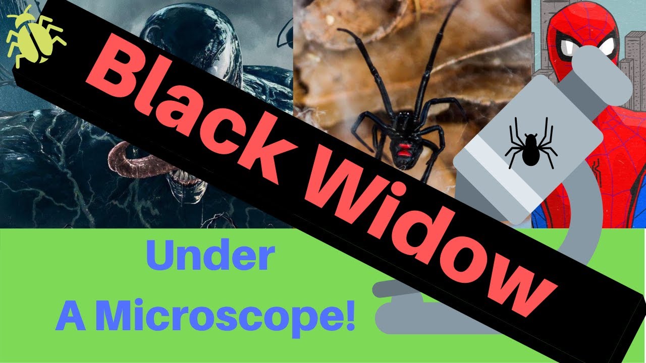BLACK WIDOW Under A Microscope!