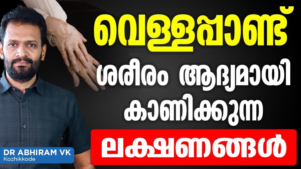 വെള്ളപ്പാണ്ട് ശരീരം ആദ്യമായി കാണിക്കുന്ന ലക്ഷണങ്ങൾ | vellapand maran | Dr Abhiram