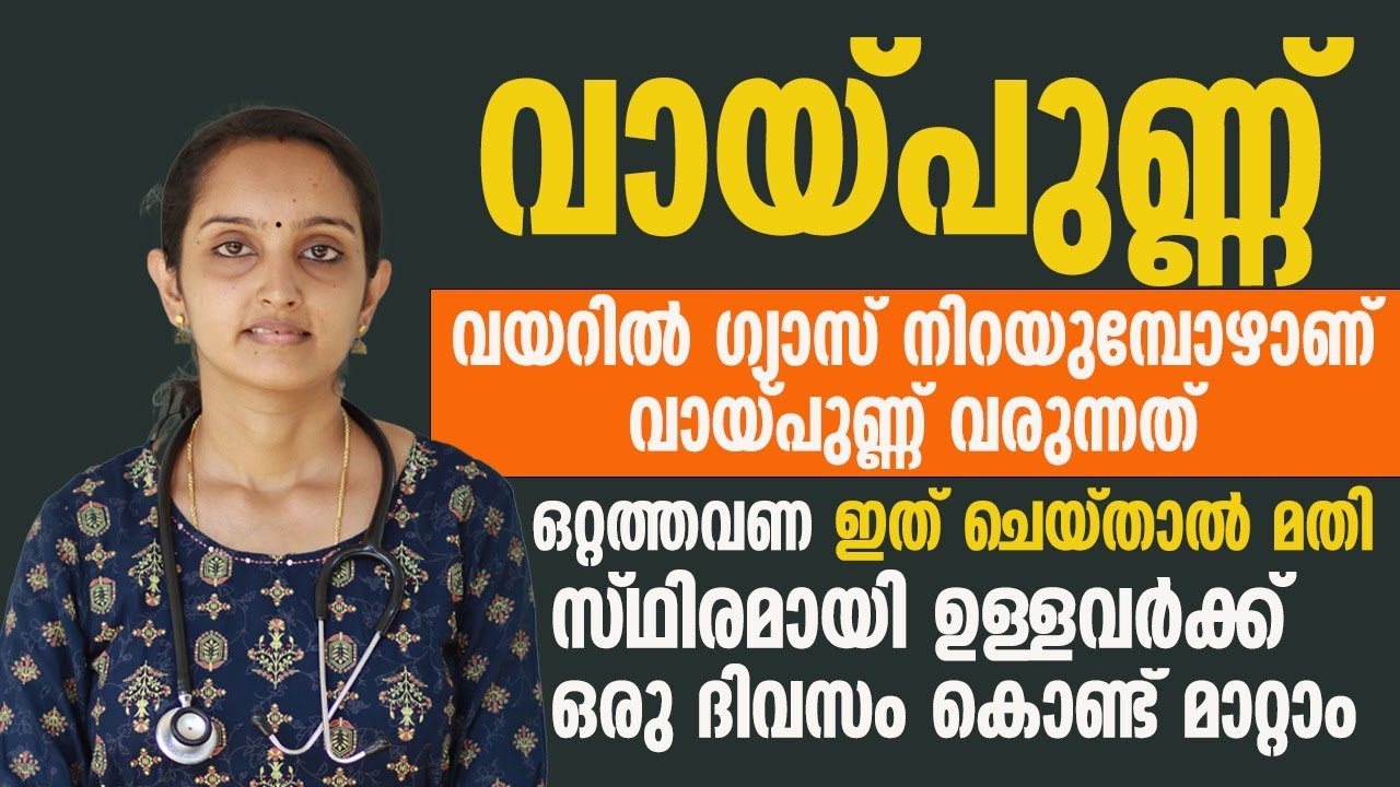 വായ്പുണ്ണ് പൂർണമായും മാറ്റാൻ തൈര് കൊണ്ട് ഇങ്ങനെ ചെയ്യൂ | vaypunn maran