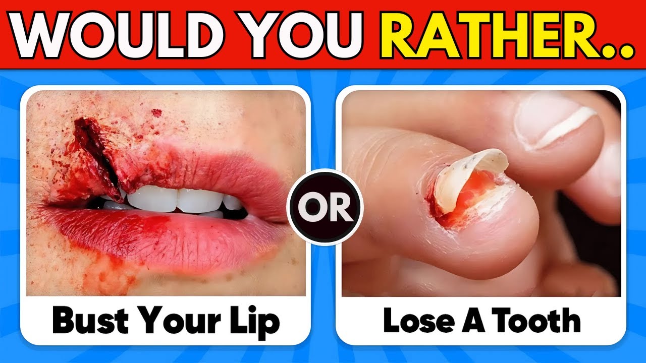 Would You Rather - 100 HARDEST Choices Ever! 😨⚠️ Warning: EXTREME Edition