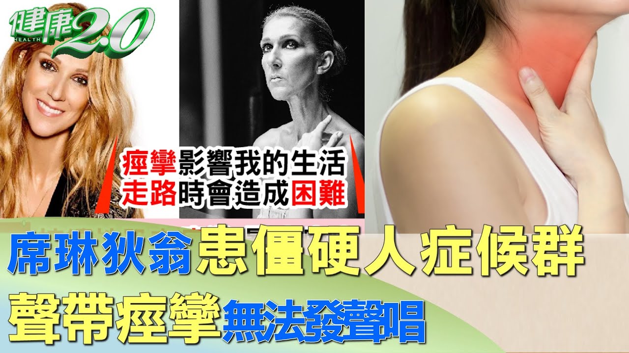 席琳狄翁患僵硬人症候群 聲帶痙攣無法發聲唱 健康2.0