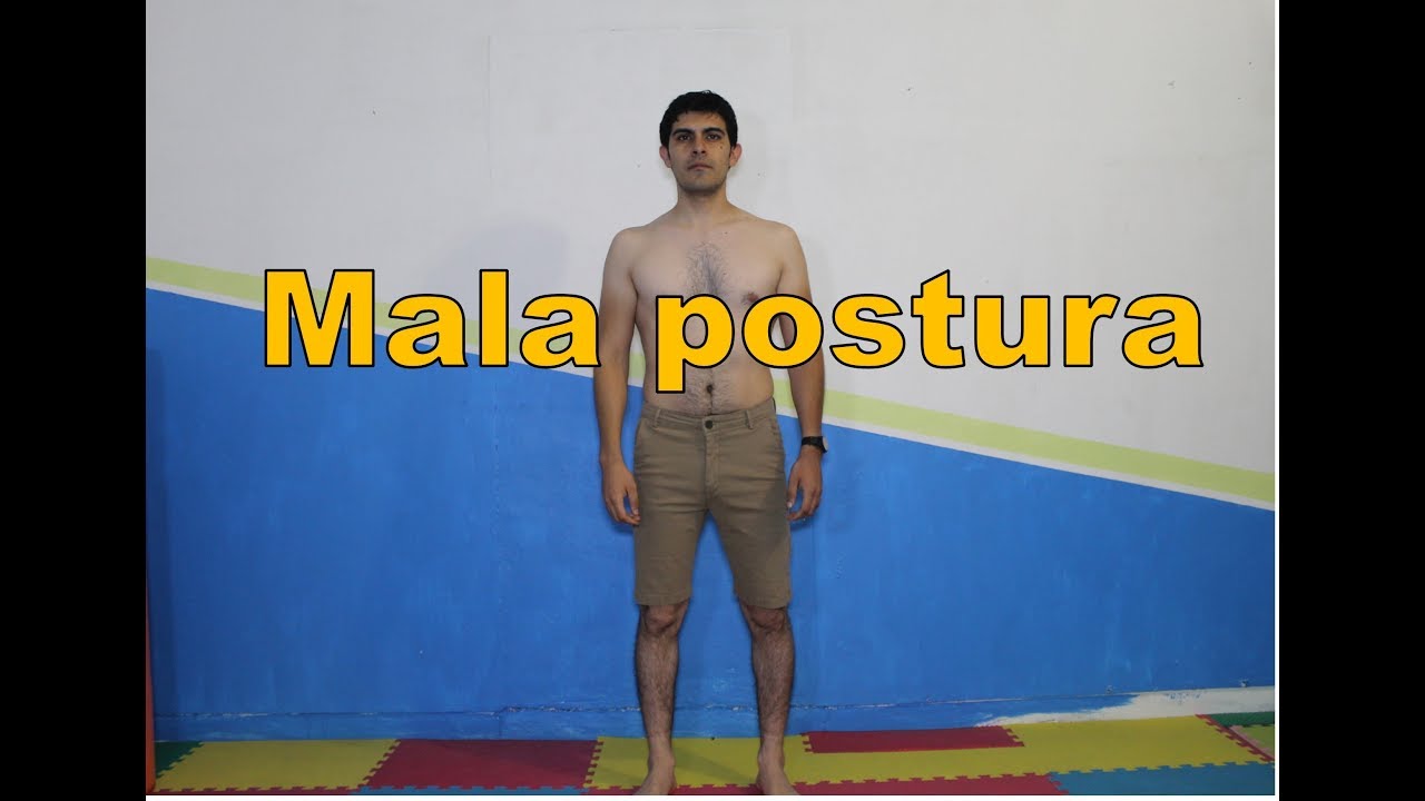 Tienes mala postura // evaluación postural
