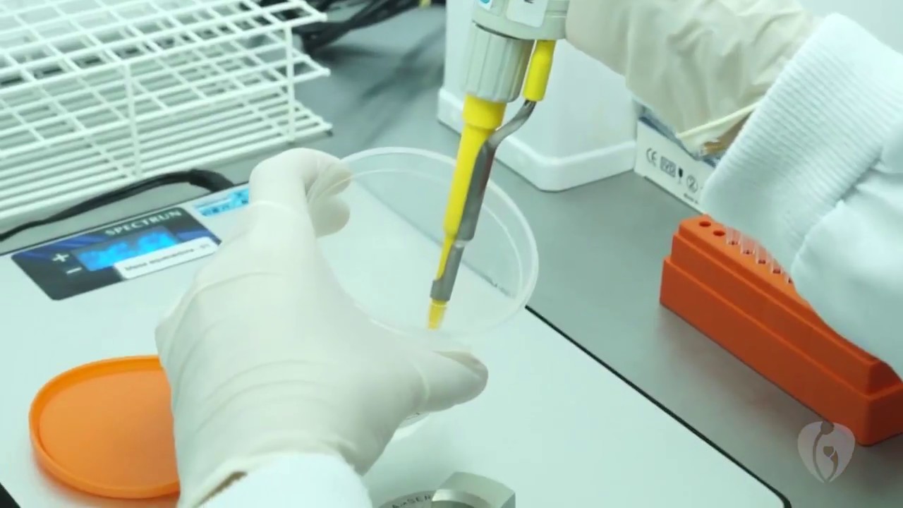 Reprodução Assistida em Foco - Inseminação Intrauterina (IIU)