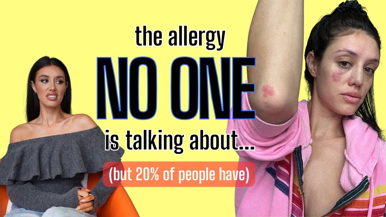 Nickel Allergy Q&A Symptoms, Causes, & How to Avoid It | Low Nickel Diet, Jewelry & Daily Struggles