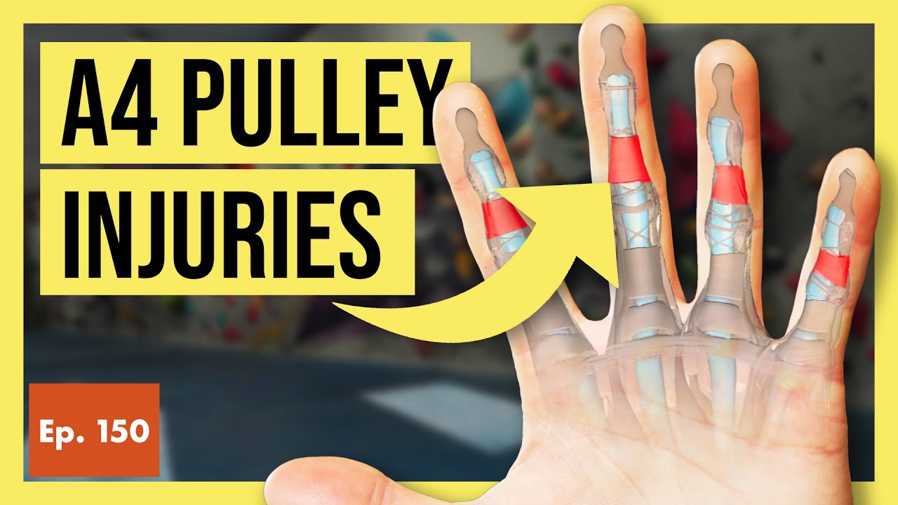 A4 Pulley Injuries in Rock Climbers (Causes, Risks, & Full Recovery)