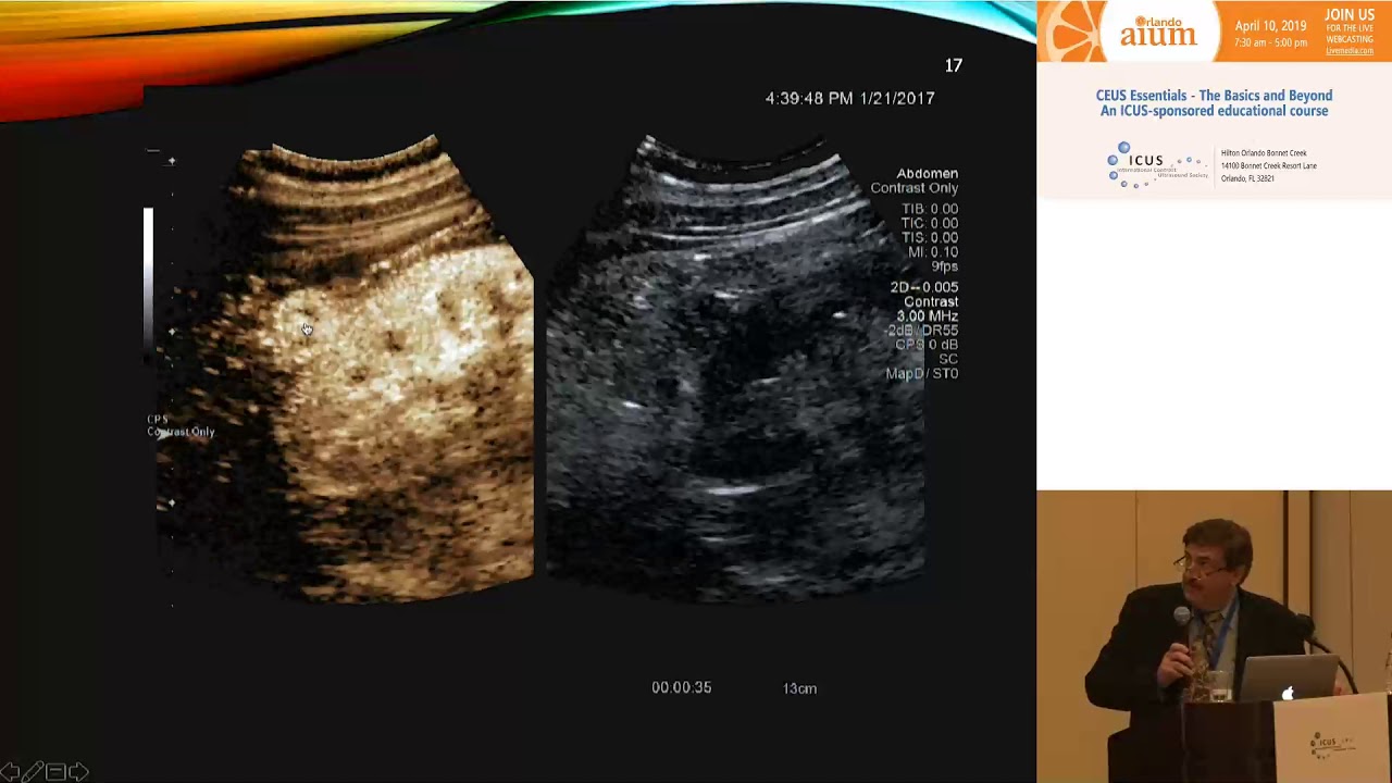 Renal CEUS