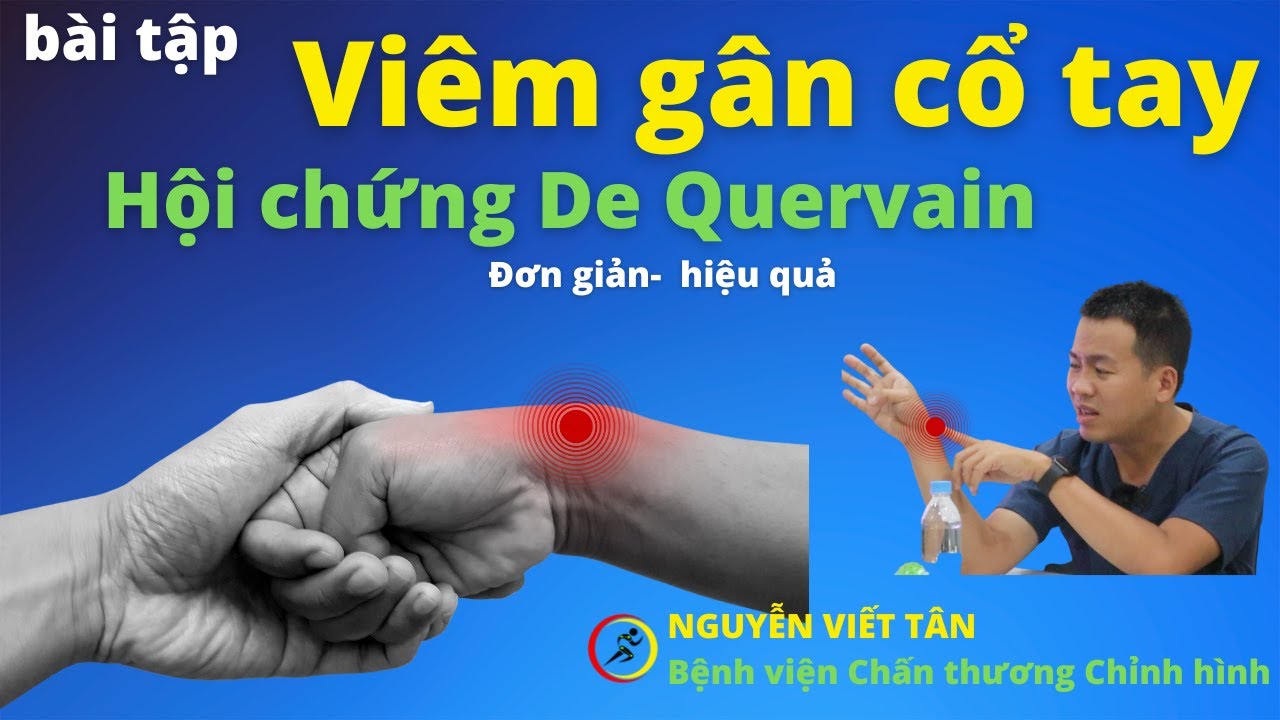 Bài tập trị viêm gân cổ tay (hội chứng De Quervain),đau gân cổ tay đơn giản, hiệu quả tại nhà