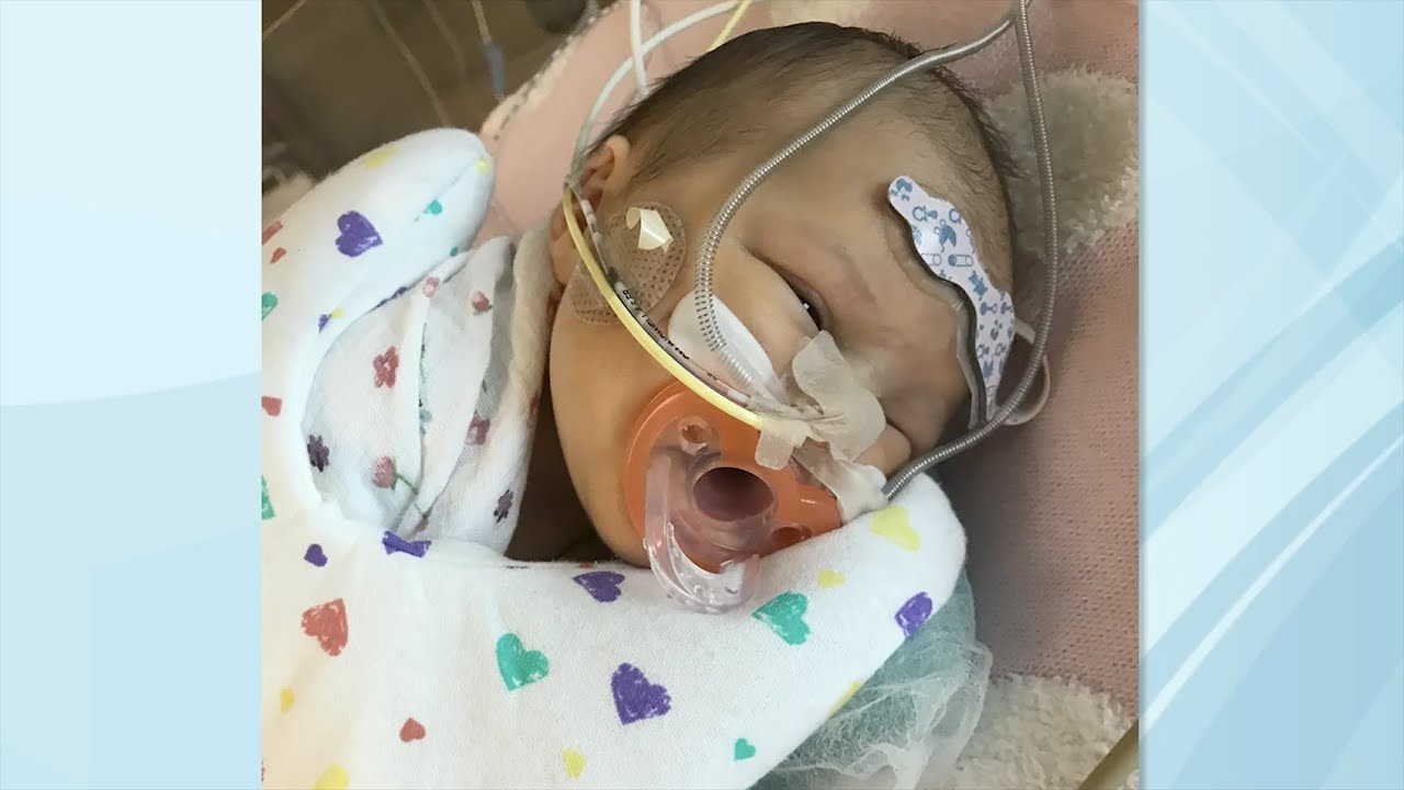 Fetal Echo Helps Discover Julianna's Transposition of the Great Arteries