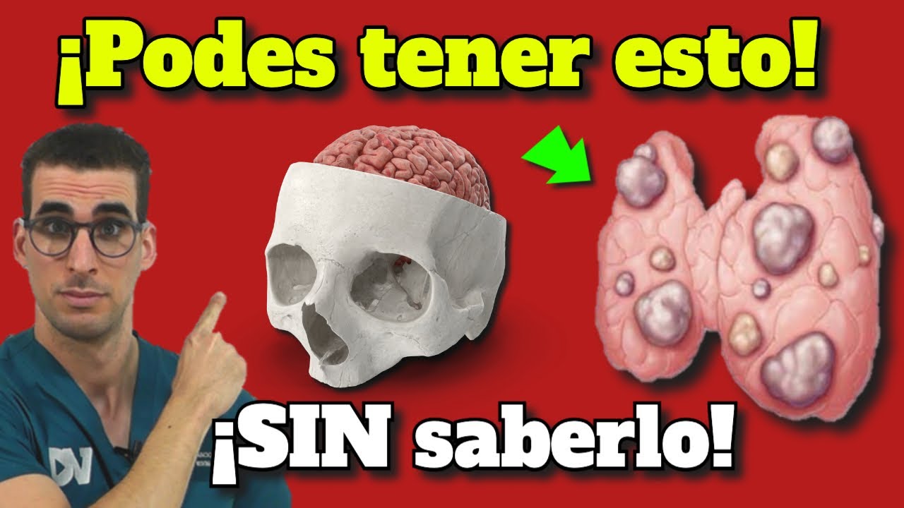 SIGNOS y SINTOMAS de HIPOTIROIDISMO| PROBLEMAS en el METABOLISMO LENTO y LA TIROIDES
