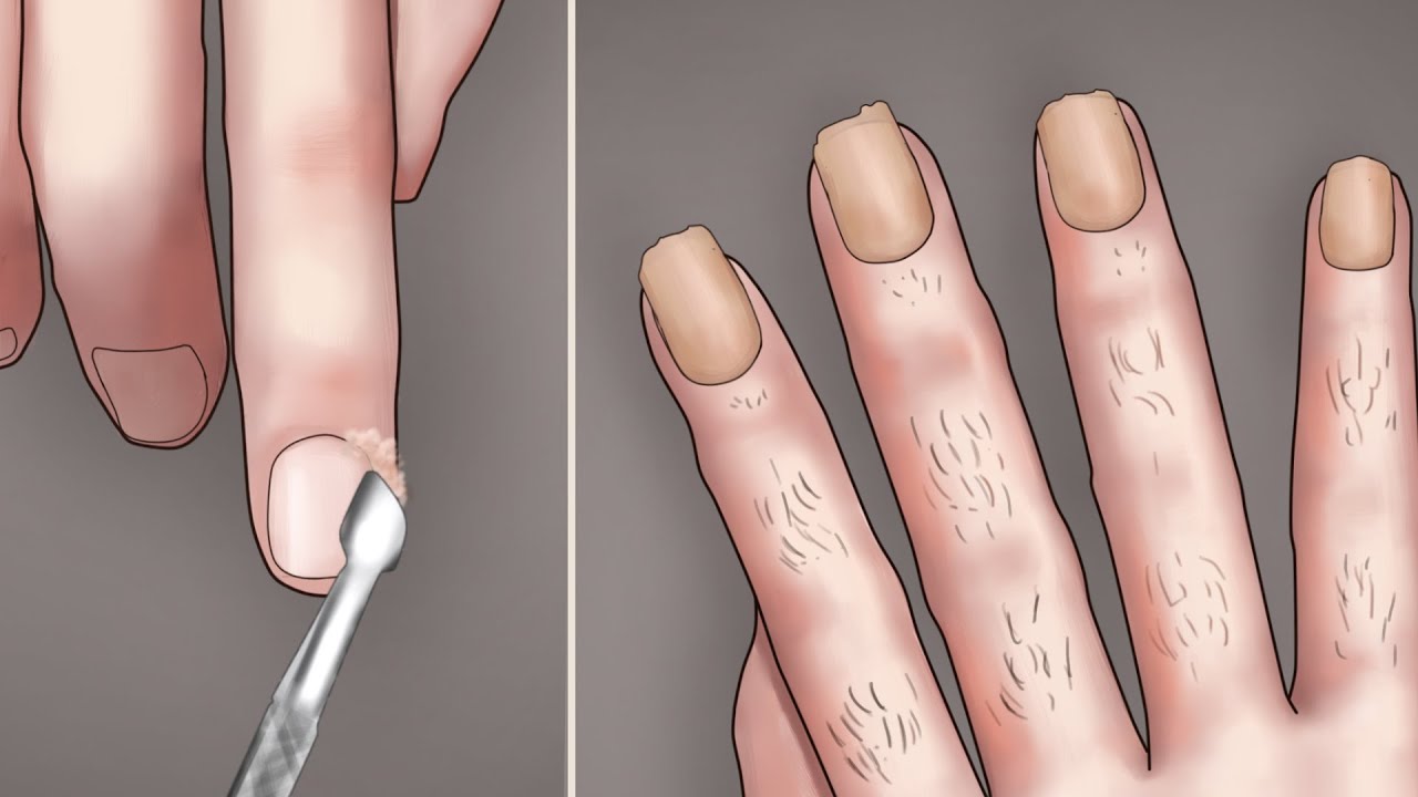 UGLY YELLOW NAILS TRANSFORMATION // ASMR Manicure process animation