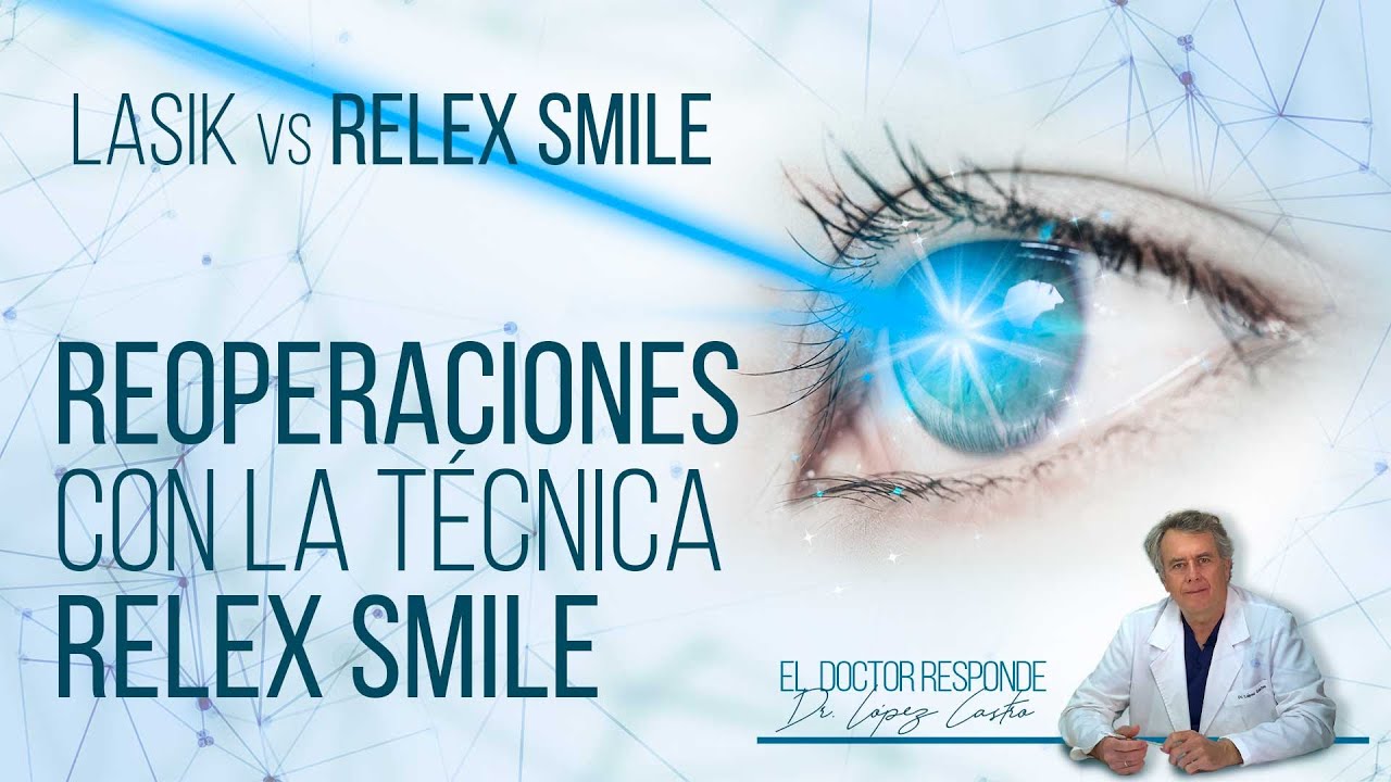 Reoperaciones con la técnica Relex Smile