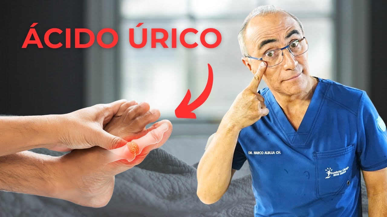 &Aacute;cido &Uacute;rico: Gu&iacute;a Completa para evitar La Gota