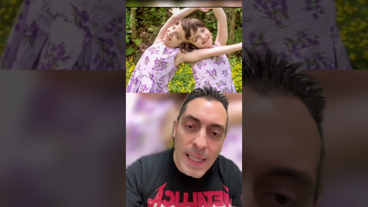 I GEMELLI SIAMESI PIU' SORPRENDENTI DELLA STORIA PT.1 UNA PUO' VEDERE QUELLO CHE VEDE L'ALTRA?