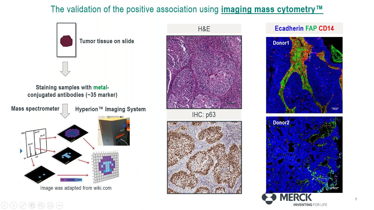 Understanding the immunosuppressive functions of CAFS in Lung Cancer