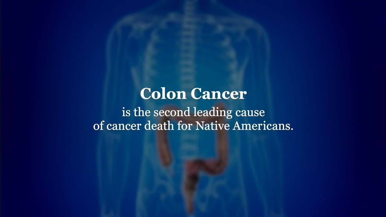 Colon Cancer Screening (East)