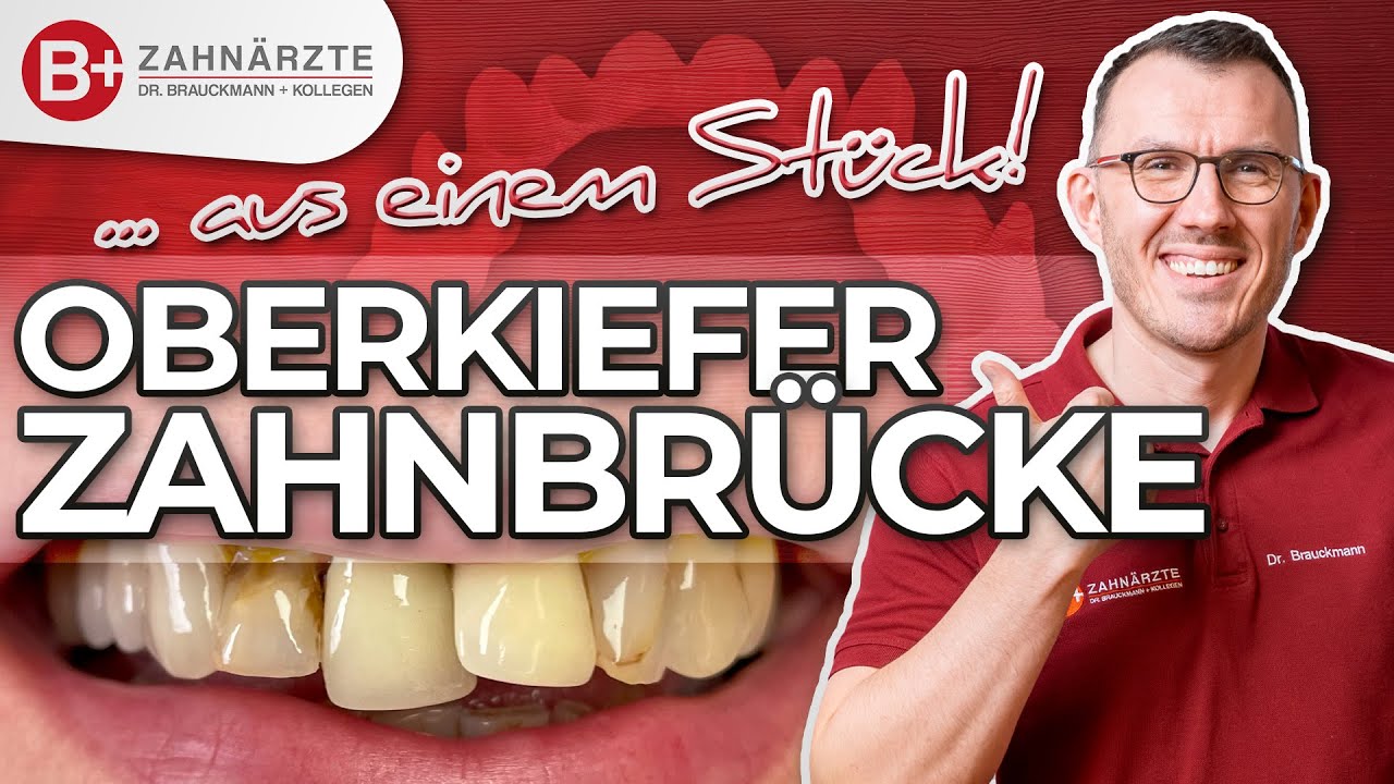 Zahnbrücke Vorher-Nachher - Echter Fall einer Patientin mit Versorgung des gesamten Oberkiefers!