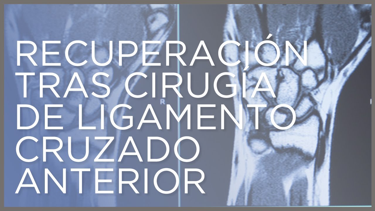 Recuperaci&oacute;n de cirug&iacute;a de Ligamento Cruzado Anterior