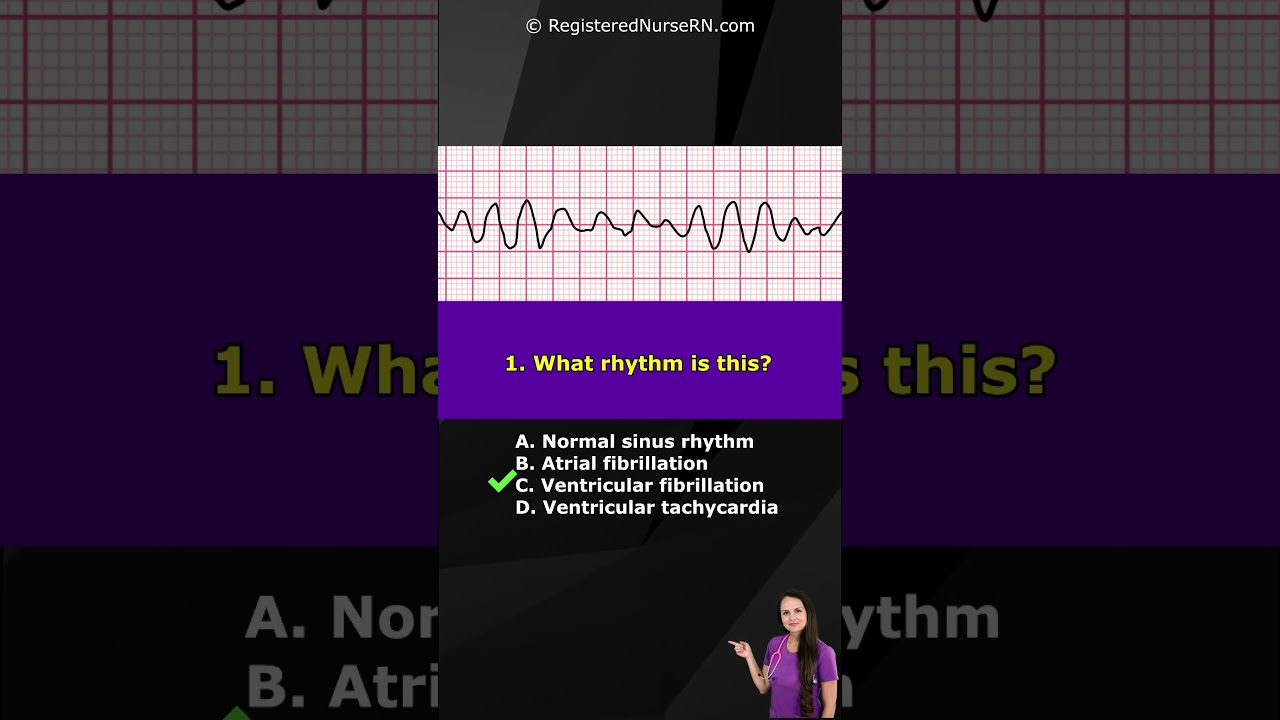 ECG Rhythm Pop Quiz: Can You Identify These EKG Rhythms? #shorts