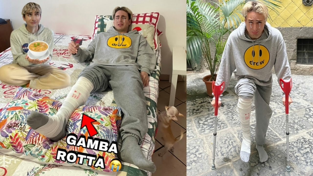 ANTO ANTO SI È ROTTO LA GAMBA E MI PRENDO CURA DI LUI!! *cammina con le stampelle*
