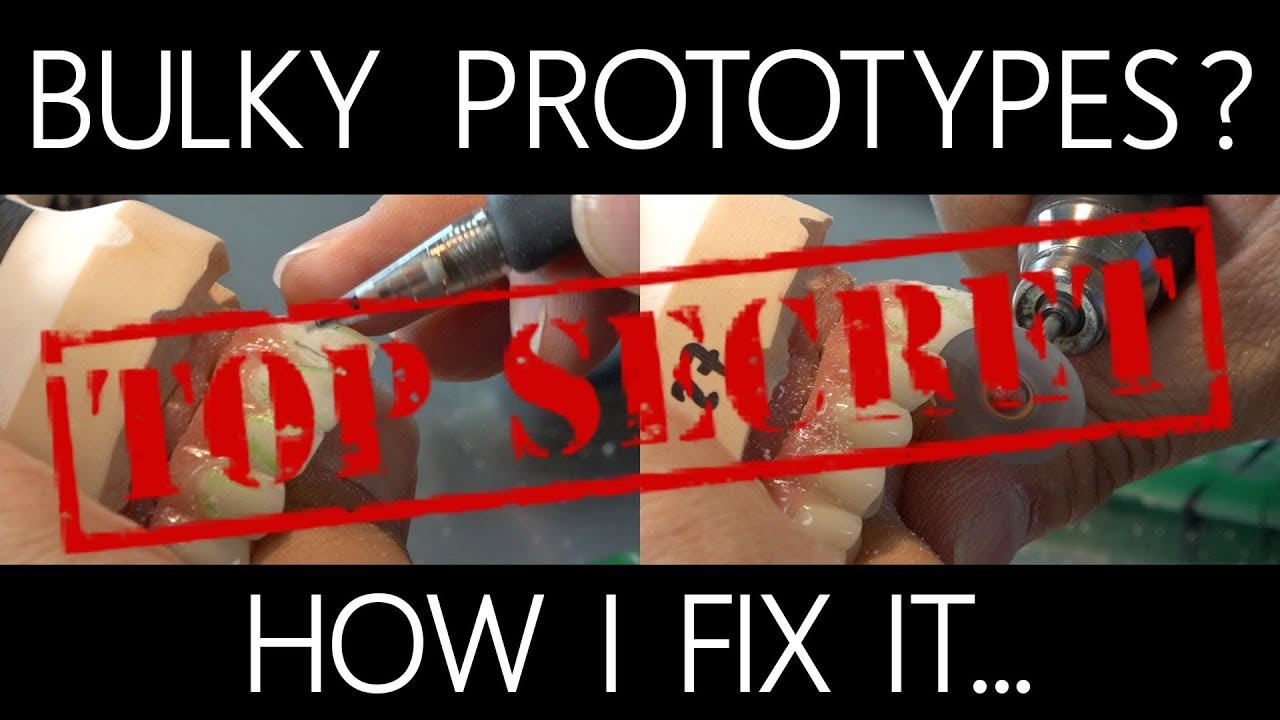Bulky Prototypes?  How I Fix It | Dental Lab Learning