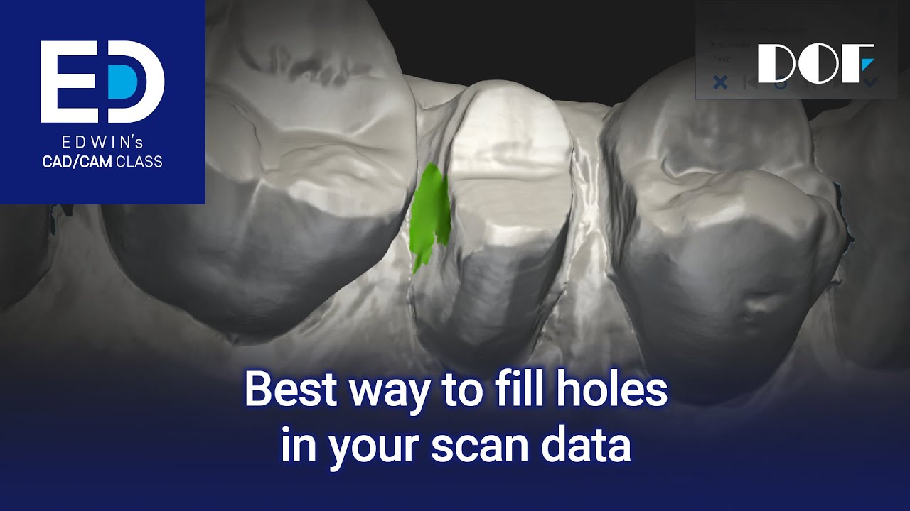 Best way to fill holes in your scan data