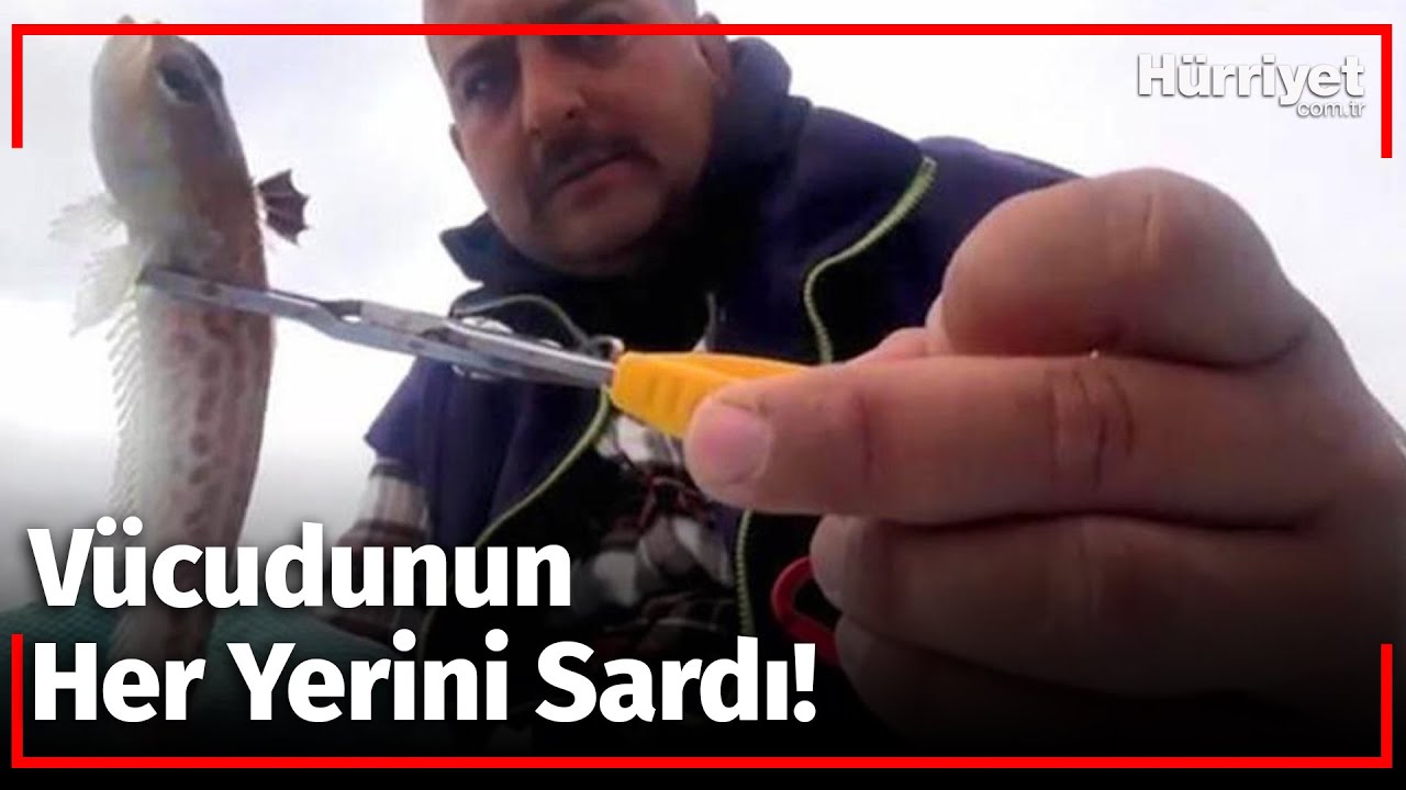 Zehirli Trakonya Balığının Teması, Balıkçıyı Hastanelik Etti!