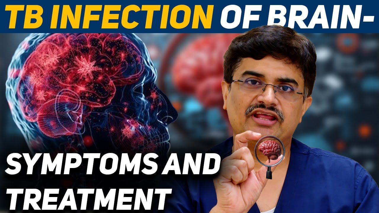 TB Infection of Brain- Symptoms and Treatment Dr.Roopesh Kumar