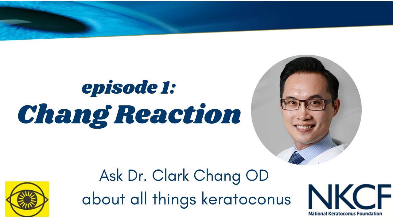 Chang Reaction Episode 1: What is Keratoconus?