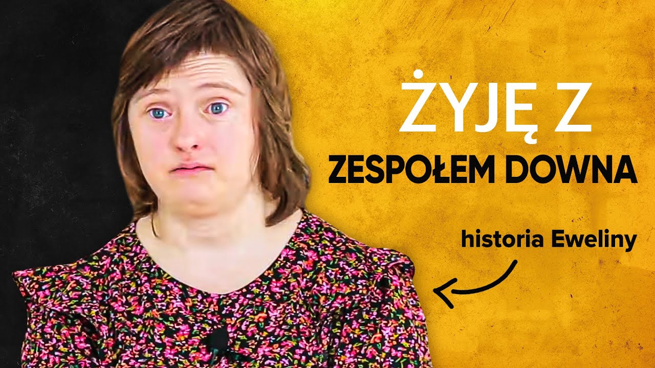 ZESPÓŁ DOWNA jak wygląda życie i praca | Żyję z