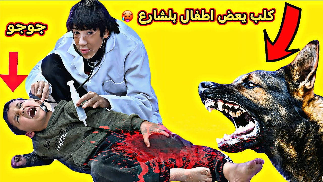 كلب يعض اطفال وطفل مات 😥