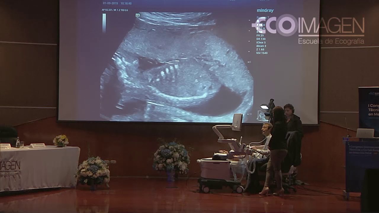 Clase 17 | Demostración práctica de Ecografía Doppler por el Dr. Eduard Gratacós