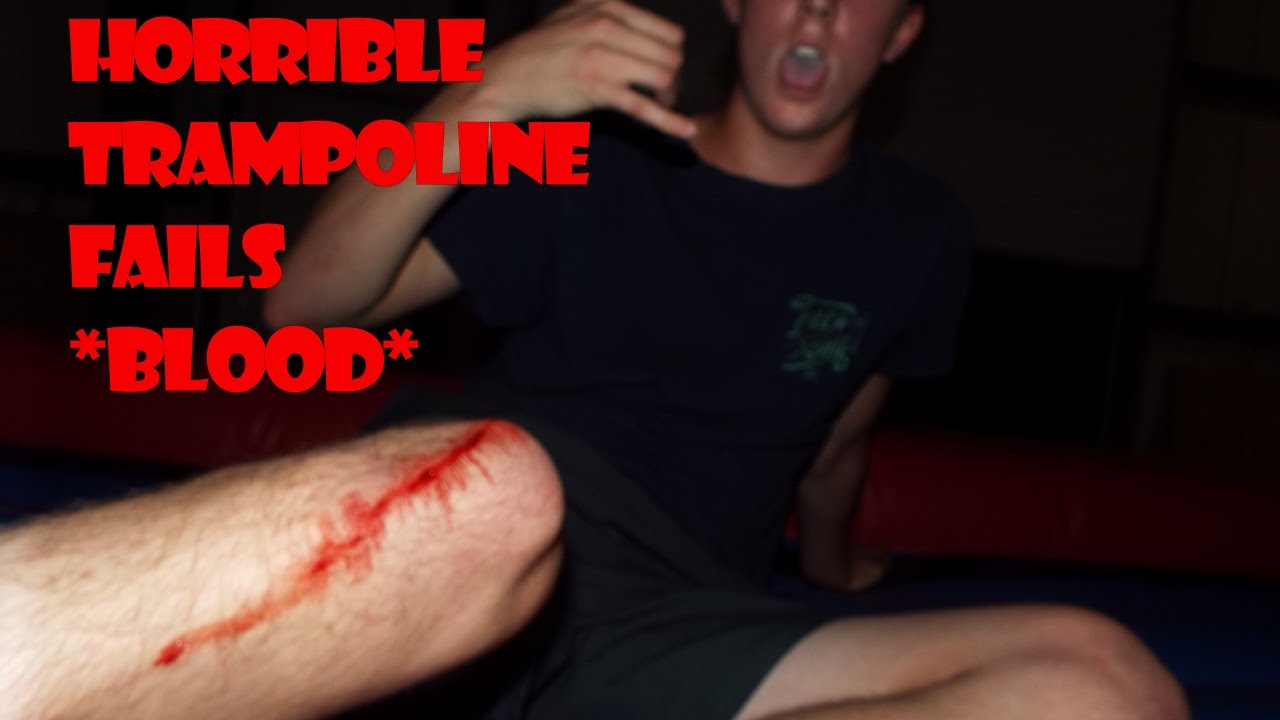 HORRIBLE TRAMPOLINE ACCIDENTS CRAZY FAILS!