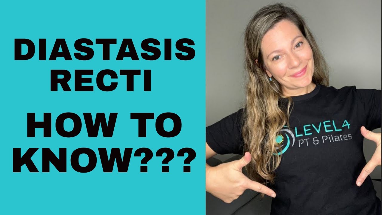Diastasis Recti: How To Know & What Does It FEEL Like?