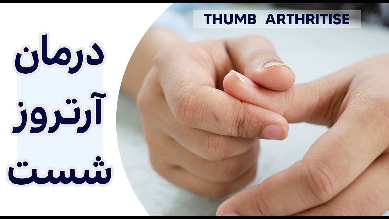 درمان آرتروز شست دست -  Thumb Arthritis Treatment Exercises