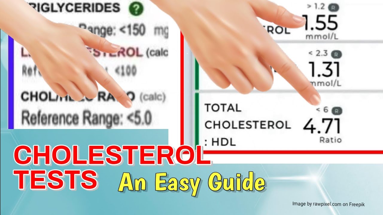 Cholesterol Tests Easy Guide