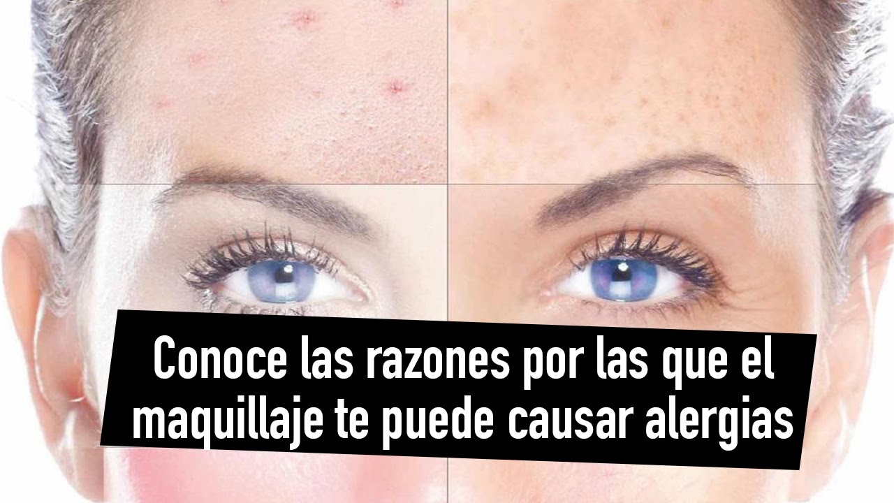 Conoce las razones por las que el maquillaje puede causar alergias
