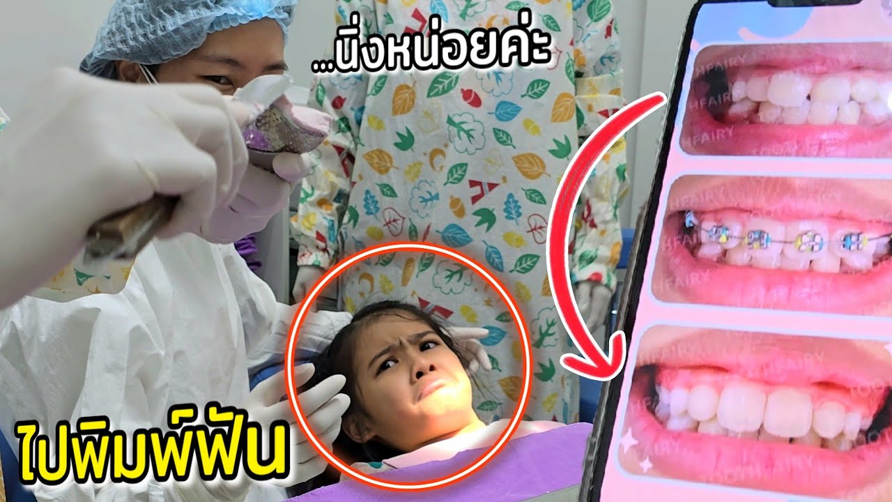ออมเล็ต ไปพิมพ์ฟัน เอ็กซ์เรย์ฟัน เตรียมจัดฟันเด็ก