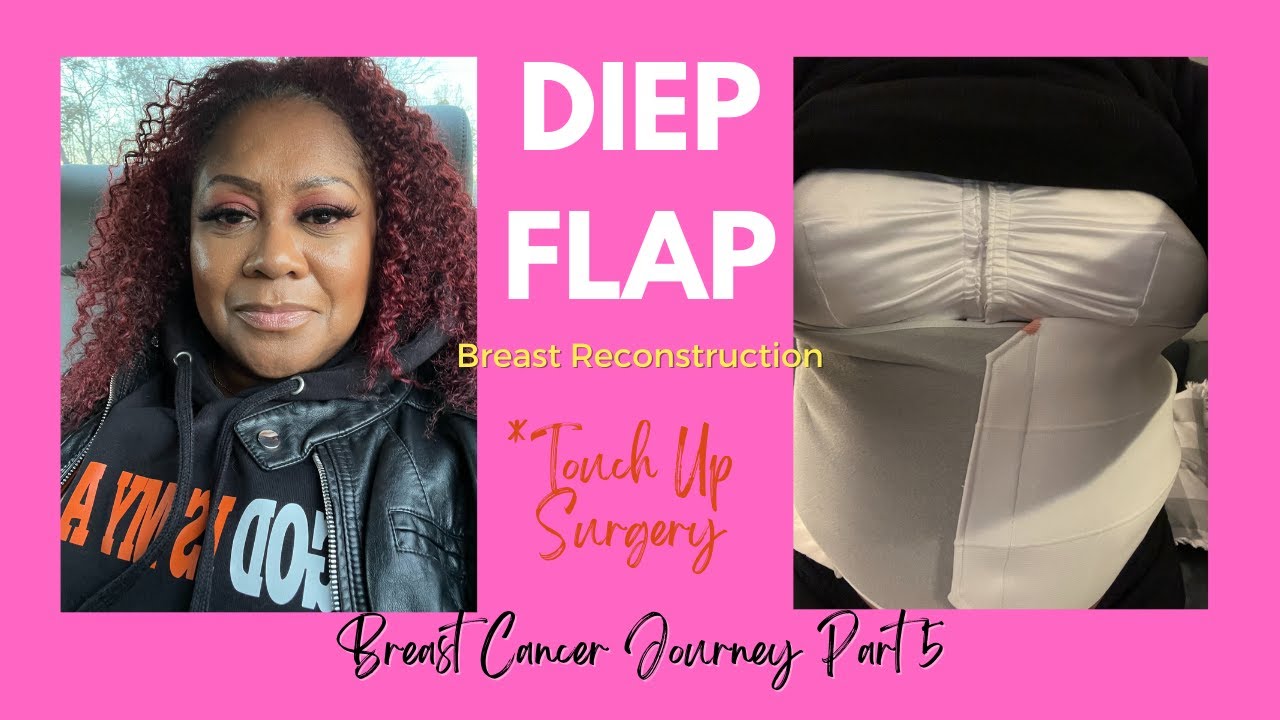 DIEP Flap Breast Reconstruction touch up surgery - I wanted to fight my anesthesiologist!