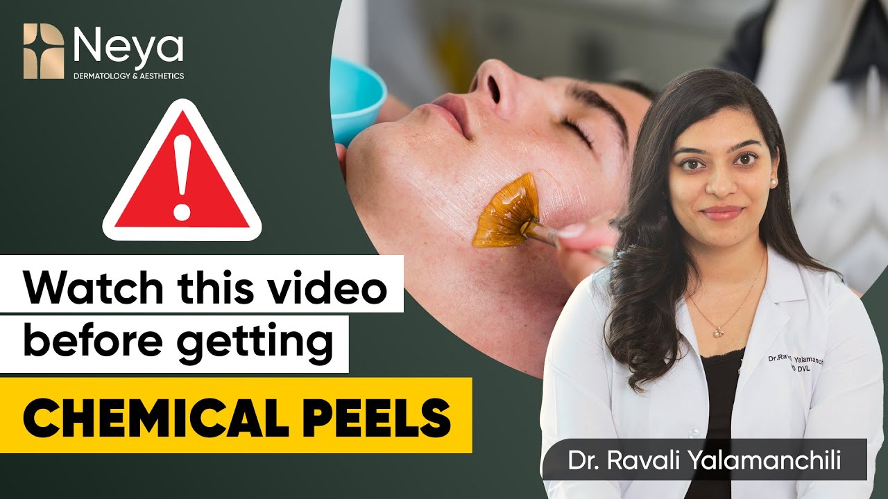 Myths and facts about Chemical Peels | Chemical peeling treatment | Neya clinic