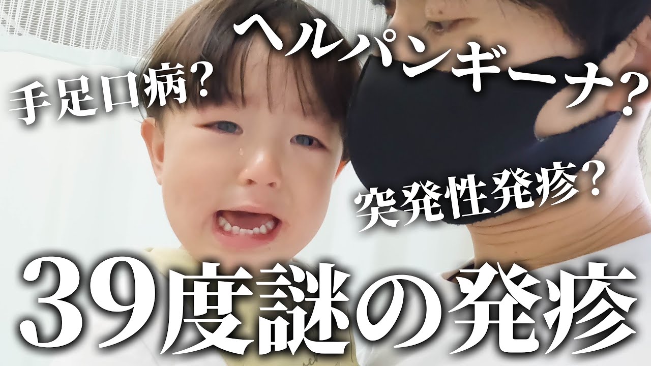 ヘルパンギーナ？手足口病？１歳児が39度高熱からの謎の発疹👶💦【共働き夫婦の育児】