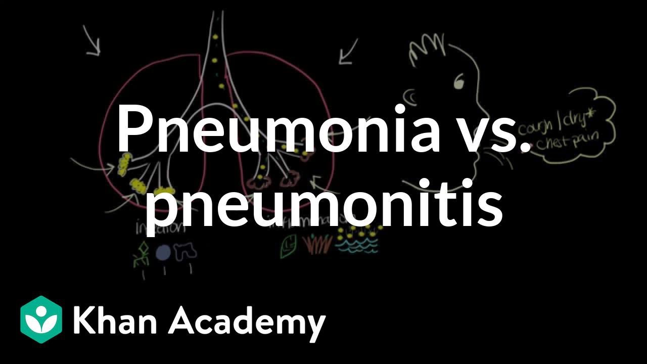 Pneumonia vs. pneumonitis | Respiratory system diseases | NCLEX-RN | Khan Academy