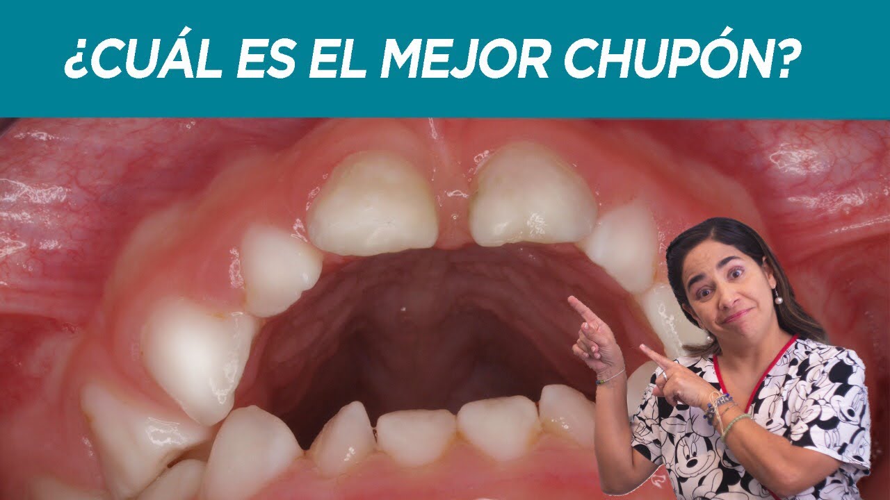 ¿Cuál es el mejor chupón / chupete?