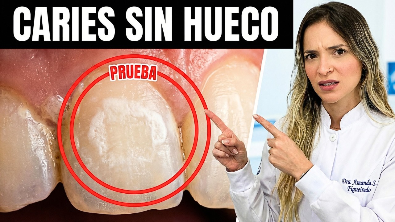 La Caries No Duele Al Inicio: Cuando Duele, Ya Llegaste Tarde