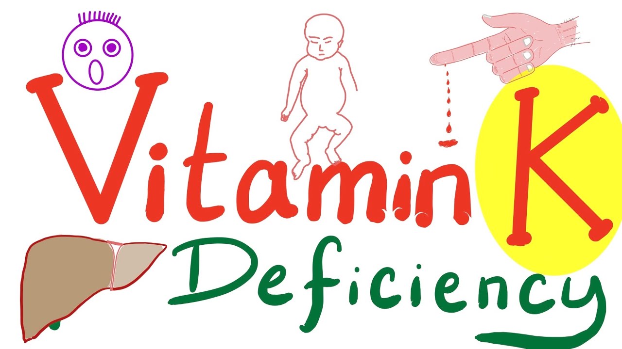 Vitamin K Deficiency - Hemorrhagic Disease of the Newborn (HDN)