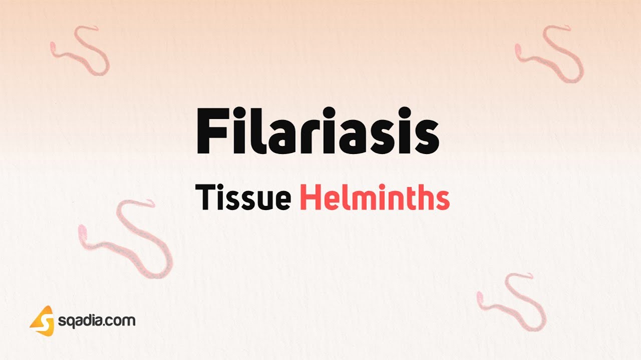 Tissue Helminths | Filariasis | Parasitology | Microbiology for Medical Students