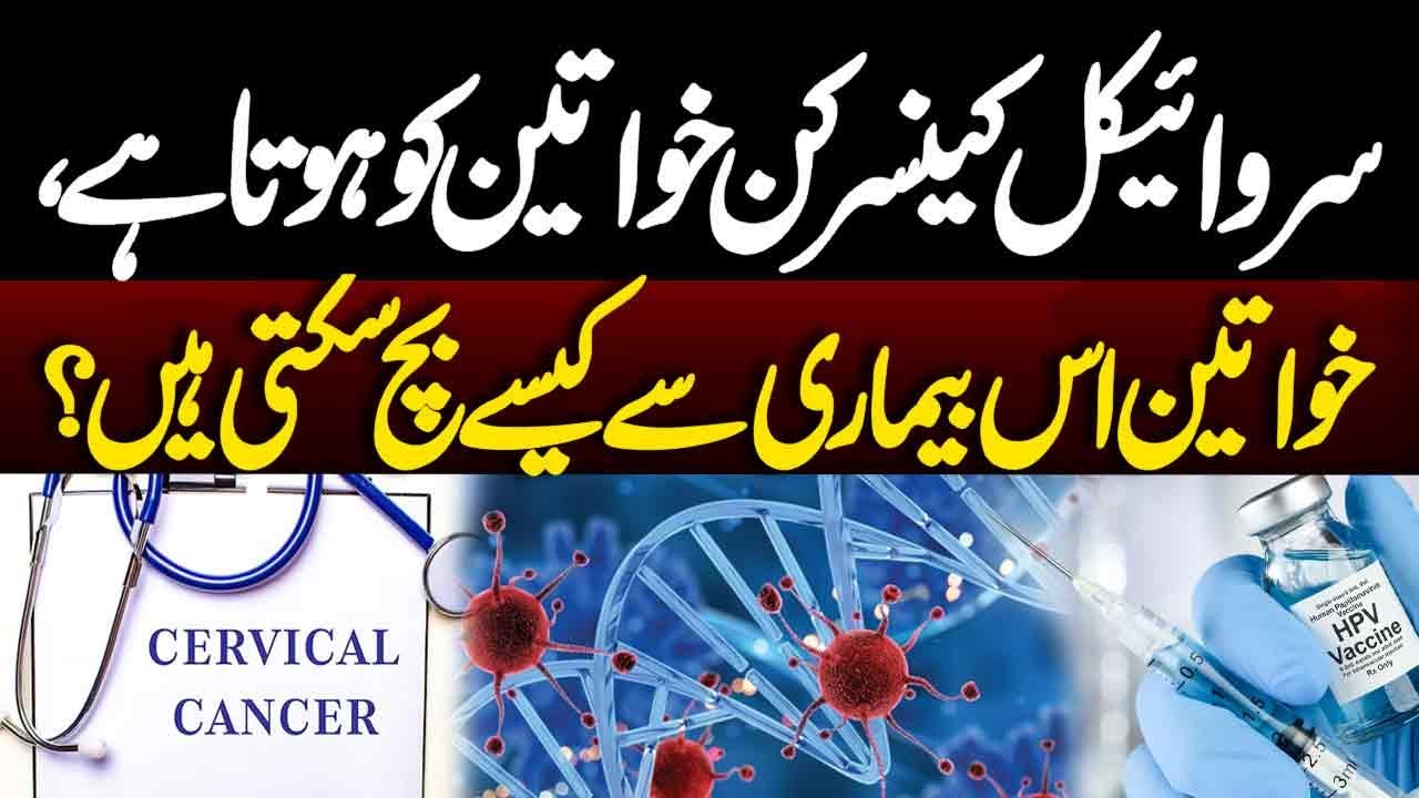 Cervical cancer symptoms and treatment | Neo Pakistan | Neo News