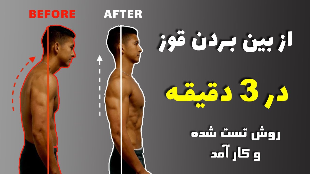 رفع قوز کمر در 3 دقیقه
