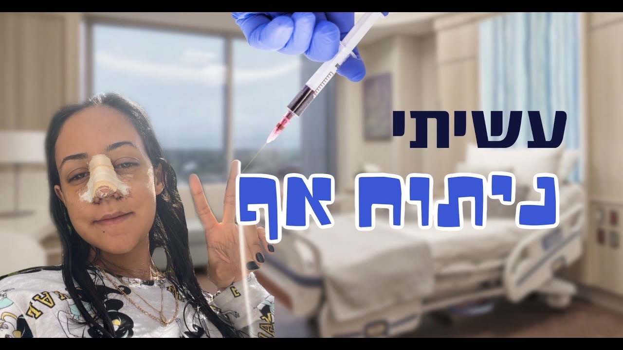 זה באמת קרה? | ולוג ניתוח אף