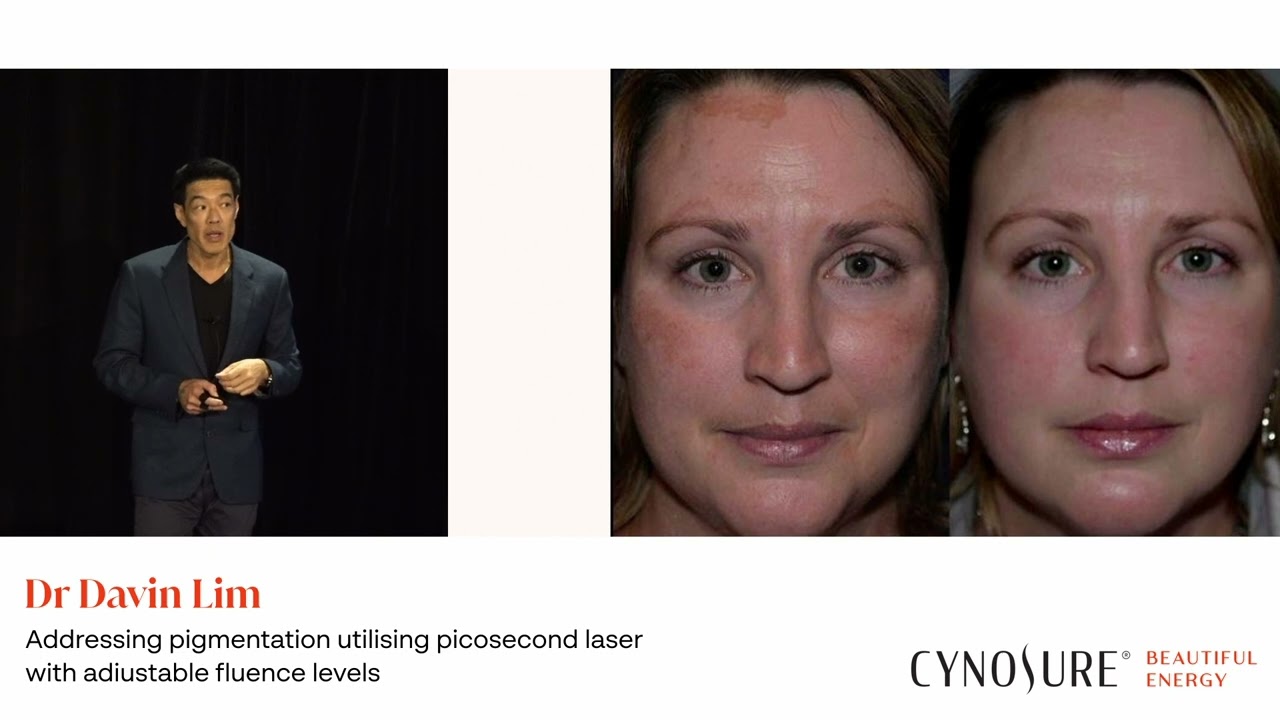 Dr Davin Lim | Picosure Pro | Cosmedicon 2023